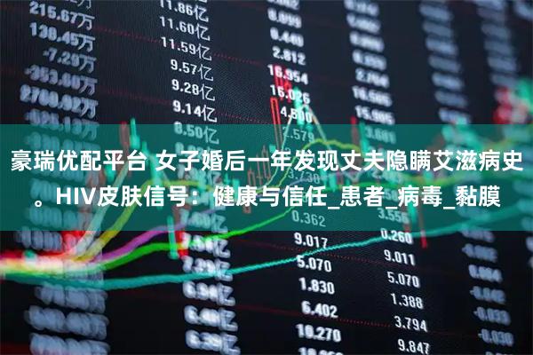 豪瑞优配平台 女子婚后一年发现丈夫隐瞒艾滋病史。HIV皮肤信号：健康与信任_患者_病毒_黏膜